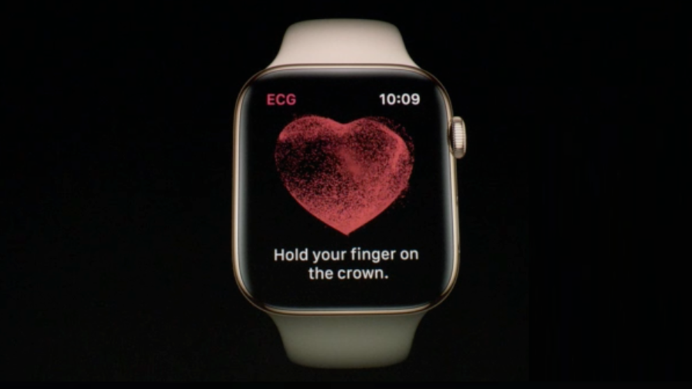 Apple watch instantly notifies you if it detects an irregular heartbeat